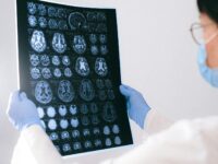 A medical professional reviewing MRI brain scans in a clinical setting, highlighting healthcare technology.