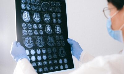 A medical professional reviewing MRI brain scans in a clinical setting, highlighting healthcare technology.