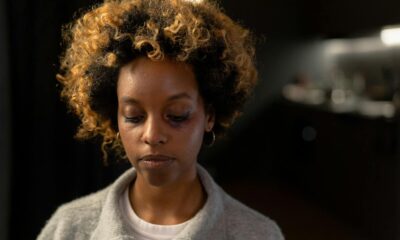 A woman with a bruise on her face, looking thoughtful in an indoor setting.